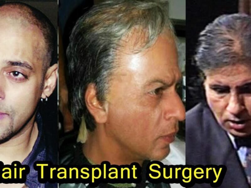 Bollywood के ये मशहूर सुपरस्टार हो चुके हैं गंजे देखकर तस्वीर,रह जाएंगे दंग