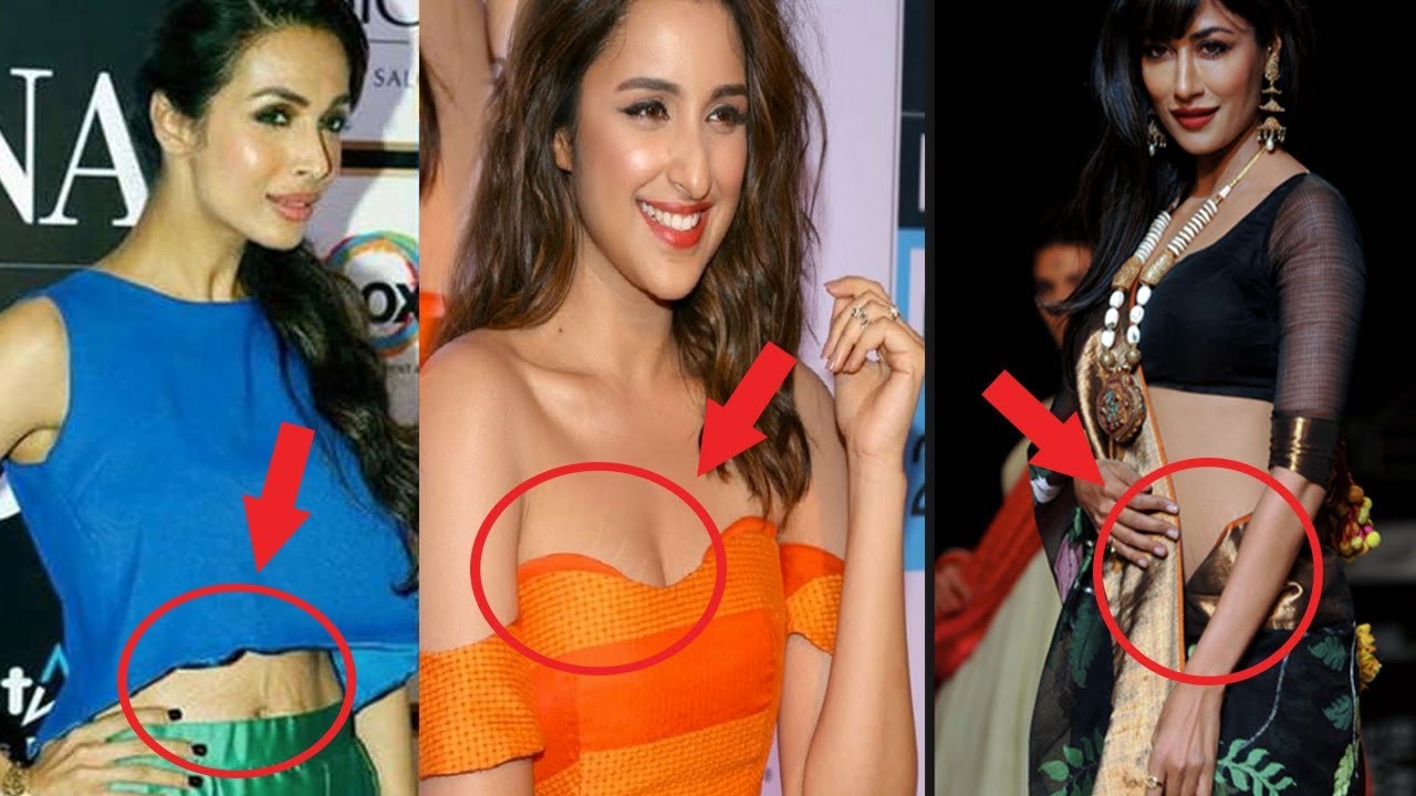 Bollywood की इन 6 अभिनेत्रियों को स्ट्रेचमार्क दिखाने में नहीं आती है शर्म, गर्व से पब्लिक में उन्हें दिखाया